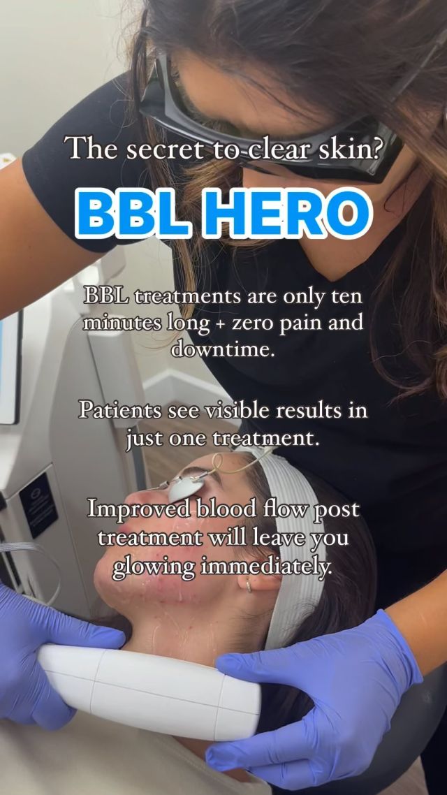 Transform your skin with the power of BBL Hero! 🌟 Discover the next level of rejuvenation and clarity!

Say goodbye to pigmentation, fine lines, and dullness as BBL Hero works its magic. Benefits include:
1️⃣ Even skin tone 
2️⃣ Reduced sun damage 
3️⃣ Smoother texture 
4️⃣ Enhanced clarity 
5️⃣ Youthful radiance

Ready to glow? Click on the link in our bio to schedule your consultation or appointment today! 

#BBLHero #SkinRejuvenation #RosenthalCosmeticAndPlasticSurgery 
#BBL #PalmBeachEsthetics #FacialsPalmBeach #PalmBeachWellness #PalmBeachLifestyle #PalmBeachLuxury #PamperMePalmBeach #SkinCarePalmBeach #PalmBeachAesthetics #HealthySkinPalmBeach #PalmBeachMedSpa